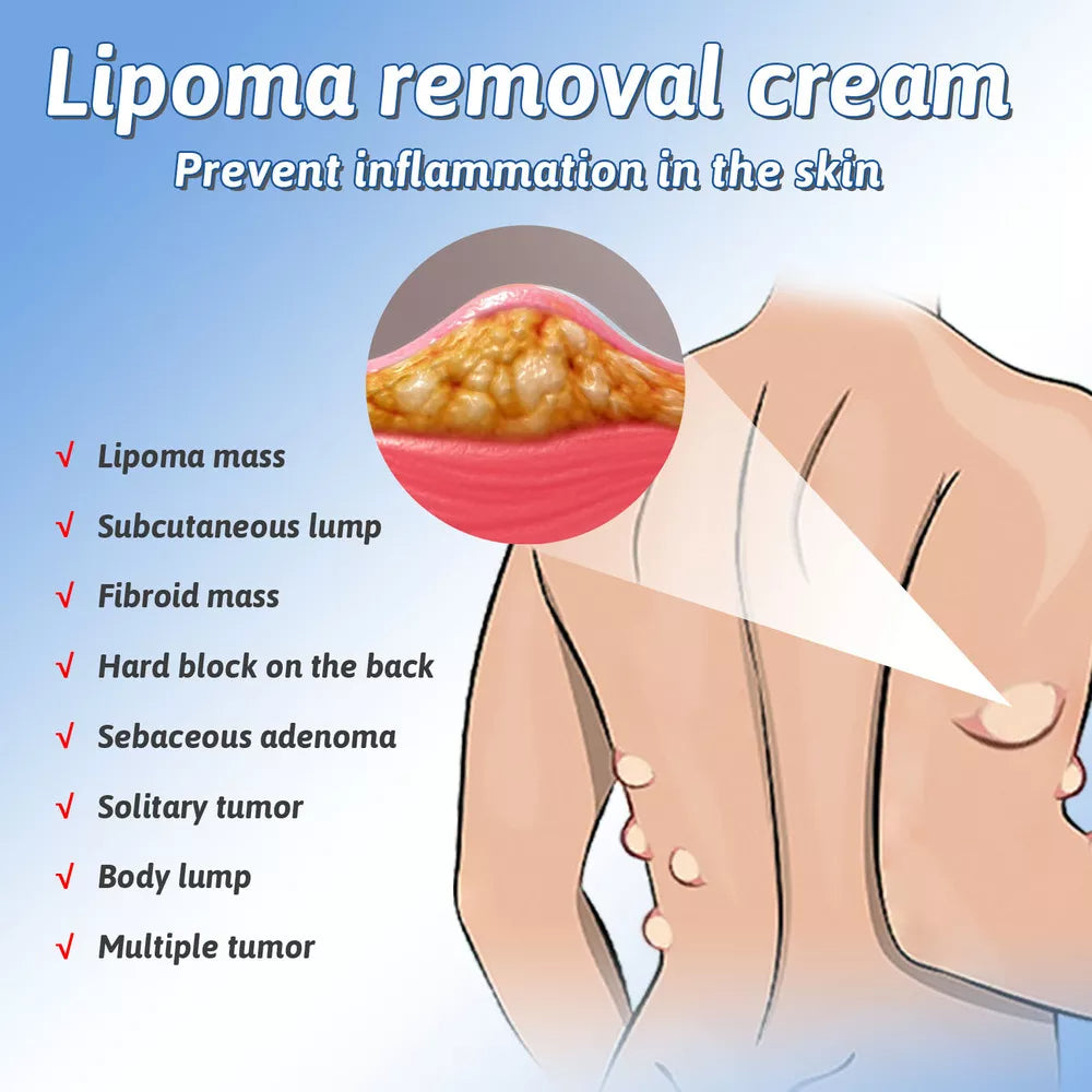 Spray Removedor De Lipomas: Paga 1 Lleva 2
